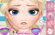 Squeeze Elsa Pimples